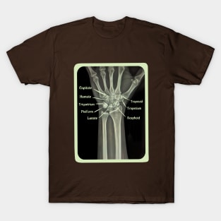 XRAY of Carpal Bones Mixed Media T-Shirt